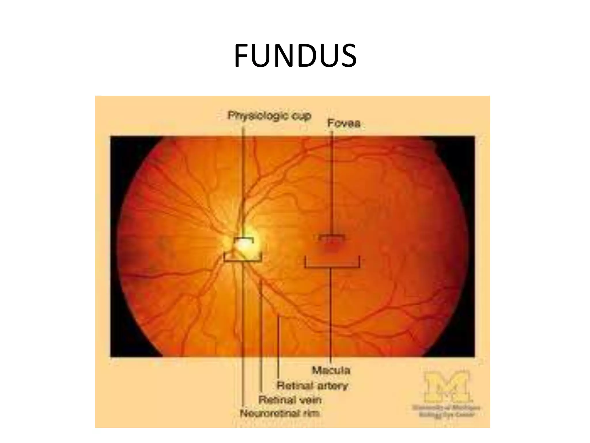 FUNDUS