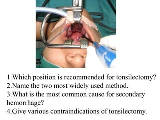 1.Which position is recommended for tonsilectomy?
2.Name the two most widely used method.
3.What is the most common cause for secondary
hemorrhage?
4.Give various contraindications of tonsilectomy.
 