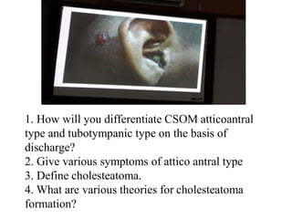 1. How will you differentiate CSOM atticoantral
type and tubotympanic type on the basis of
discharge?
2. Give various symptoms of attico antral type
3. Define cholesteatoma.
4. What are various theories for cholesteatoma
formation?
 