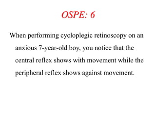 OSPE: 6
When performing cycloplegic retinoscopy on an
anxious 7-year-old boy, you notice that the
central reflex shows with movement while the
peripheral reflex shows against movement.
 