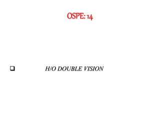 OSPE: 14
 H/O DOUBLE VISION
 