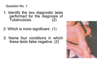 Question No. 1
1: Identify the two diagnostic tests
performed for the diagnosis of
Tuberculosis. (2)
2: Which is more significant. (1)
3: Name four conditions in which
these tests false negative. (2)
 