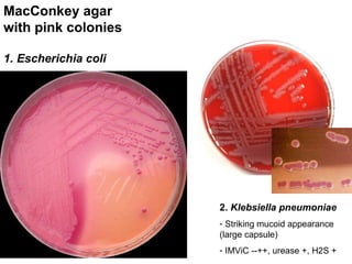 MacConkey agar with pink colonies ,[object Object],[object Object],[object Object],[object Object]