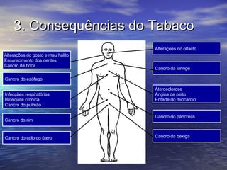 3. Consequências do Tabaco
                                   Alterações do olfacto
Alterações do gosto e mau hálito
Escurecimento dos dentes
Cancro da boca
                                   Cancro da laringe

Cancro do esófago

                                   Aterosclerose
Infecções respiratórias            Angina de peito
Bronquite crónica                  Enfarte do miocárdio
Cancro do pulmão

                                   Cancro do pâncreas
Cancro do rim



Cancro do colo do útero            Cancro da bexiga
 