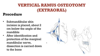 Marginal Ramus test of teeth of human body of tooth.pptx