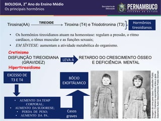 • Os hormônios tireoidianos atuam na homeostase: regulam a pressão, o ritmo
cardíaco, o tônus muscular e as funções sexuais;
• EM SÍNTESE: aumentam a atividade metabólica do organismo.
BIOLOGIA, 2° Ano do Ensino Médio
Os principais hormônios
Tirosina(AA) Tiroxina (T4) e Triodotironina (T3)
TIREOIDE Hormônios
tireoidianos
Cretinismo
DISFUNÇÃO TIREOIDIANA
(GRAVIDEZ)
RETARDO DO CRESCIMENTO ÓSSEO
E DEFICIÊNCIA MENTAL
LEVA A
Hipertireoidismo
EXCESSO DE
T3 E T4
• AUMENTO DA TEMP
CORPORAL;
• AUMENTO DA SUDORESE;
• PERDA DE PESO;
• AUMENTO DA PA .
BÓCIO
EXOFTÁLMICO
Casos
graves
google/imagens
Imagem
de
cima
para
baixo:
Fuelbottle/
Public
Domain;
Cretinismo
esporádico
antes
e
após
tratamento/
Autor
Desconhecido/
Public
Domain
 