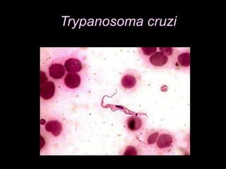 Trypanosoma cruzi