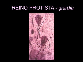 REINO PROTISTA - giárdia