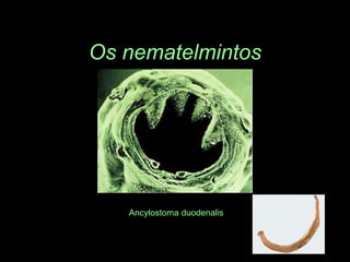 Os nematelmintosAncylostoma duodenalis