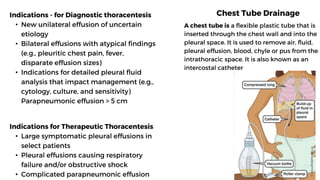 Indications - for Diagnostic thoracentesis
• New unilateral effusion of uncertain
etiology
• Bilateral effusions with atypical findings
(e.g., pleuritic chest pain, fever,
disparate effusion sizes)
• Indications for detailed pleural fluid
analysis that impact management (e.g.,
cytology, culture, and sensitivity)
Parapneumonic effusion > 5 cm
Indications for Therapeutic Thoracentesis
• Large symptomatic pleural effusions in
select patients
• Pleural effusions causing respiratory
failure and/or obstructive shock
• Complicated parapneumonic effusion
Chest Tube Drainage
A chest tube is a flexible plastic tube that is
inserted through the chest wall and into the
pleural space. It is used to remove air, fluid,
pleural effusion, blood, chyle or pus from the
intrathoracic space. It is also known as an
intercostal catheter
 