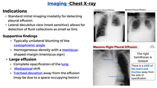 Imaging -Chest X-ray
Indications
• Standard initial imaging modality for detecting
pleural effusion.
• Lateral decubitus view (most sensitive): allows for
detection of fluid collections as small as 5mL
Unilateral Pleural Effusion Bilateral Pleural Effusion
Supportive findings
⚬ Typically unilateral blunting of the
costophrenic angle
⚬ Homogeneous density with a meniscus-
shaped margin (meniscus sign)
• Large effusion
⚬ Complete opacification of the lung
⚬ Mediastinal shift
⚬ Tracheal deviation away from the effusion
(may be due to a space-occupying lesion)
 