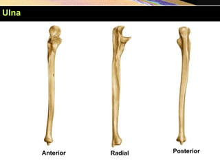 Anterior Posterior
Radial
Ulna
 
