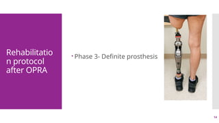 14
Rehabilitatio
n protocol
after OPRA
 Phase 3- Definite prosthesis
 