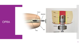 9
OPRA
 
