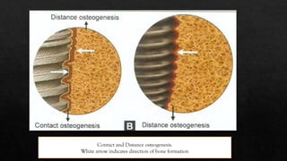 OSSEO INTEGRATION Of Bone In Human Body PPTX osseo-integration-of-bone-in-human-body-pptx