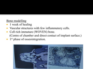 Bone modelling
 1 week of healing
 Vascular structures with few inflammatory cells.
 Cell rich immature (WOVEN) bone.
(Centre of chamber and direct contact of implant surface.)
 1st phase of osseointegration.
 