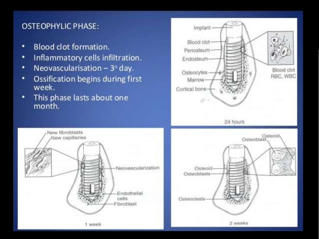 "OSSEOINTEGRATION"