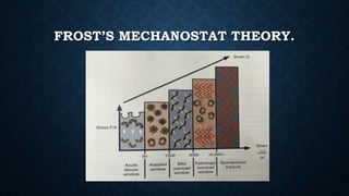 FROST’S MECHANOSTAT THEORY.
 