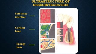 ULTRASTRUCTURE OF
OSSEOINTEGRATION
Soft tissue
interface
Cortical
bone
Spongy
bone
 