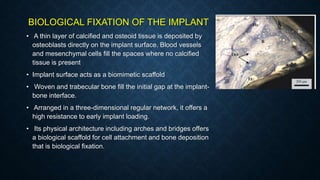 BIOLOGICAL FIXATION OF THE IMPLANT
• A thin layer of calcified and osteoid tissue is deposited by
osteoblasts directly on the implant surface. Blood vessels
and mesenchymal cells fill the spaces where no calcified
tissue is present
• Implant surface acts as a biomimetic scaffold
• Woven and trabecular bone fill the initial gap at the implant-
bone interface.
• Arranged in a three-dimensional regular network, it offers a
high resistance to early implant loading.
• Its physical architecture including arches and bridges offers
a biological scaffold for cell attachment and bone deposition
that is biological fixation.
 