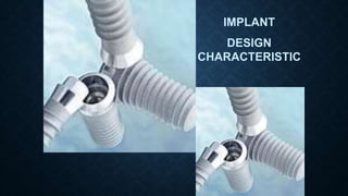 IMPLANT
DESIGN
CHARACTERISTIC
 