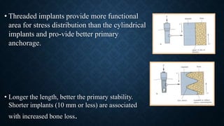 • Threaded implants provide more functional
area for stress distribution than the cylindrical
implants and pro-vide better primary
anchorage.
• Longer the length, better the primary stability.
Shorter implants (10 mm or less) are associated
with increased bone loss.
 