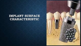 IMPLANT SURFACE
CHARACTERISTIC
 