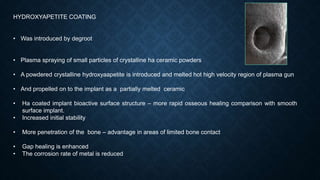 HYDROXYAPETITE COATING
• Was introduced by degroot
• Plasma spraying of small particles of crystalline ha ceramic powders
• A powdered crystalline hydroxyaapetite is introduced and melted hot high velocity region of plasma gun
• And propelled on to the implant as a partially melted ceramic
• Ha coated implant bioactive surface structure – more rapid osseous healing comparison with smooth
surface implant.
• Increased initial stability
• More penetration of the bone – advantage in areas of limited bone contact
• Gap healing is enhanced
• The corrosion rate of metal is reduced
 