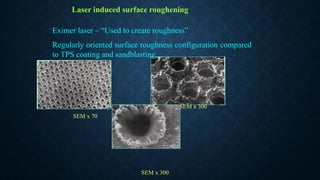 Laser induced surface roughening
Eximer laser – “Used to create roughness”
Regularly oriented surface roughness configuration compared
to TPS coating and sandblasting
SEM x 300
SEM x 300
SEM x 70
 