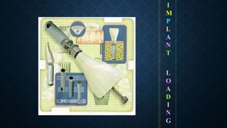 I
M
P
L
A
N
T
L
O
A
D
I
N
G
 