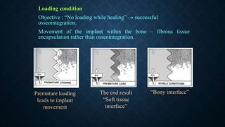 Loading condition
Objective : “No loading while healing”  successful
osseointegration.
Movement of the implant within the bone – fibrous tissue
encapsulation rather than osseointegration.
Premature loading
leads to implant
movement
The end result
“Soft tissue
interface”
“Bony interface”
 