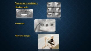 Non-invasive methods :
•Radiographs
•Periotest
•Reverse torque
 