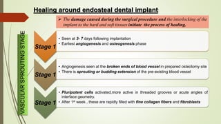 Healing around endosteal dental implant:
Stage 1
• Seen at 3- 7 days following implantation
• Earliest angiogenesis and osteogenesis phase
Stage 1
• Angiogenesis seen at the broken ends of blood vessel in prepared osteotomy site
• There is sprouting or budding extension of the pre-existing blood vessel
Stage 1
• Pluripotent cells activated,more active in threaded grooves or acute angles of
interface geometry.
• After 1st week , these are rapidly filled with fine collagen fibers and fibroblasts
VASCULARSPROUTINGSTAGE
 The damage caused during the surgical procedure and the interlocking of the
implant to the hard and soft tissues initiate the process of healing.
 