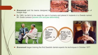  Branemark and his teams designed titanium screws and inserted them into the jaws of
beagle dogs.
 By 1965, he felt it to be ready for use in humans and placed 4 implants in a Swede named
Mr. Gosta Larsson {severe chin and jaw deformities}.
 Branemark began training the first Swedish dental experts his techniques in October 1977.
However , it was
the 1983 Toronto
conference when
Branemark’s
work finally was
universally
accepted.
In Sweden ,
osseo-
integrated
implants
became
acceptable by
1977
 
