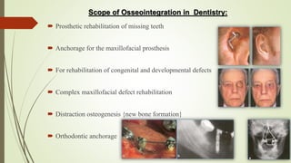  Prosthetic rehabilitation of missing teeth
 Anchorage for the maxillofacial prosthesis
 For rehabilitation of congenital and developmental defects
 Complex maxillofacial defect rehabilitation
 Distraction osteogenesis {new bone formation}
 Orthodontic anchorage
Scope of Osseointegration in Dentistry:
 