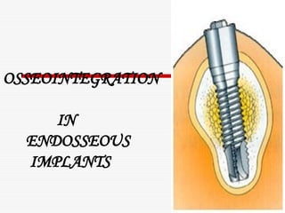 Osseointegration in dental implant and the | PPT