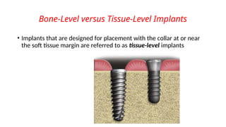 Bone-Level versus Tissue-Level Implants
• Implants that are designed for placement with the collar at or near
the soft tissue margin are referred to as tissue-level implants
 