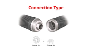 Connection Type
 