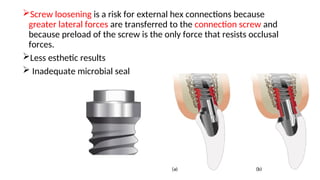 Screw loosening is a risk for external hex connections because
greater lateral forces are transferred to the connection screw and
because preload of the screw is the only force that resists occlusal
forces.
Less esthetic results
 Inadequate microbial seal
 