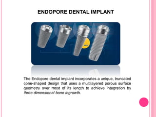 ENDOPORE DENTAL IMPLANT
The Endopore dental implant incorporates a unique, truncated
cone-shaped design that uses a multilayered porous surface
geometry over most of its length to achieve integration by
three dimensional bone ingrowth.
 