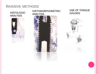 INVASIVE METHODS
HISTOLOGIC
ANALYSIS
HISTOMORPHOMETRIC
ANALYSIS
USE OF TORQUE
GAUGES
 