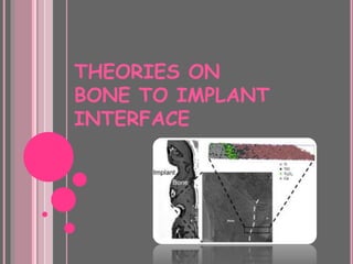 THEORIES ON
BONE TO IMPLANT
INTERFACE
 