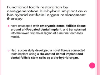  have enveloped with embryonic dental follicle tissue
around a HA-coated dental implant, and transplanted
into the lower first molar region of a murine tooth-loss
model.
 Had successfully developed a novel fibrous connected
tooth implant using a HA-coated dental implant and
dental follicle stem cells as a bio-hybrid organ.
 