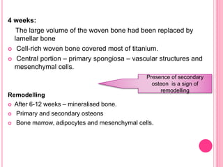 4 weeks:
The large volume of the woven bone had been replaced by
lamellar bone
 Cell-rich woven bone covered most of titanium.
 Central portion – primary spongiosa – vascular structures and
mesenchymal cells.
Remodelling
 After 6-12 weeks – mineralised bone.
 Primary and secondary osteons
 Bone marrow, adipocytes and mesenchymal cells.
Presence of secondary
osteon is a sign of
remodelling
 