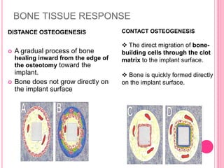 BONE TISSUE RESPONSE
DISTANCE OSTEOGENESIS
 A gradual process of bone
healing inward from the edge of
the osteotomy toward the
implant.
 Bone does not grow directly on
the implant surface
CONTACT OSTEOGENESIS
 The direct migration of bone-
building cells through the clot
matrix to the implant surface.
 Bone is quickly formed directly
on the implant surface.
 