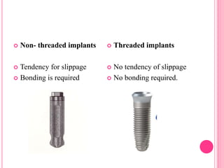  Non- threaded implants
 Tendency for slippage
 Bonding is required
 Threaded implants
 No tendency of slippage
 No bonding required.
 