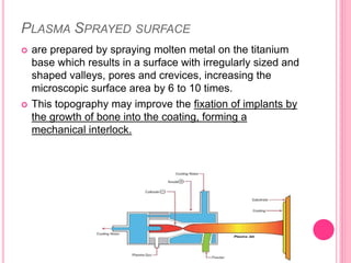 PLASMA SPRAYED SURFACE
 are prepared by spraying molten metal on the titanium
base which results in a surface with irregularly sized and
shaped valleys, pores and crevices, increasing the
microscopic surface area by 6 to 10 times.
 This topography may improve the fixation of implants by
the growth of bone into the coating, forming a
mechanical interlock.
 