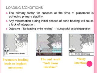 LOADING CONDITIONS
 The primary factor for success at the time of placement is
achieving primary stability.
 Any micromotion during initial phases of bone healing will cause
a lack of integration.
 Objective : “No loading while healing”  successful osseointegration.
Premature loading
leads to implant
movement
The end result
“Soft tissue
interface”
“Bony
interface”
 