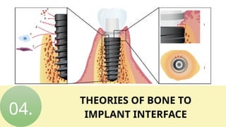 Osseointegration _20251004_085103_0000.pptx