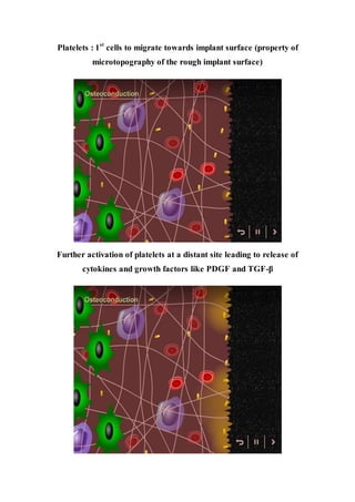 Platelets : 1st
cells to migrate towards implant surface (property of
microtopography of the rough implant surface)
Further activation of platelets at a distant site leading to release of
cytokines and growth factors like PDGF and TGF-β
 